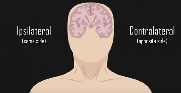 Ipsilateral Vs Contralateral, What Do These Words Refer To?