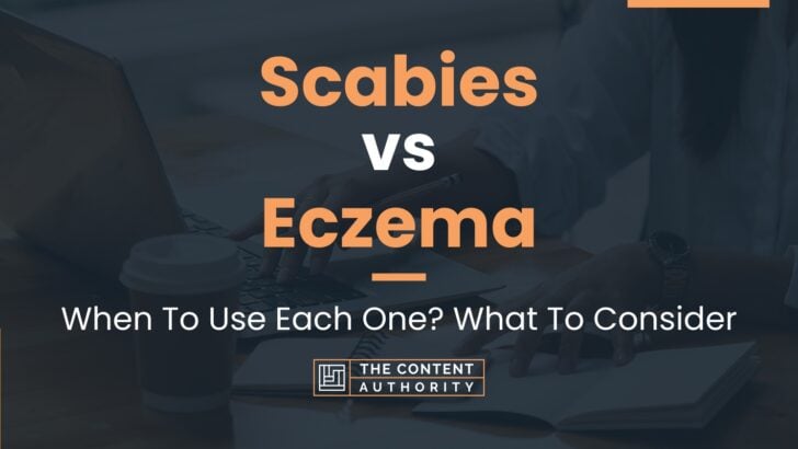 Scabies Vs Eczema: When To Use Each One? What To Consider