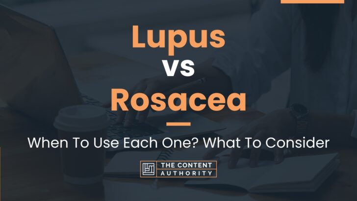 Lupus Vs Rosacea When To Use Each One What To Consider 