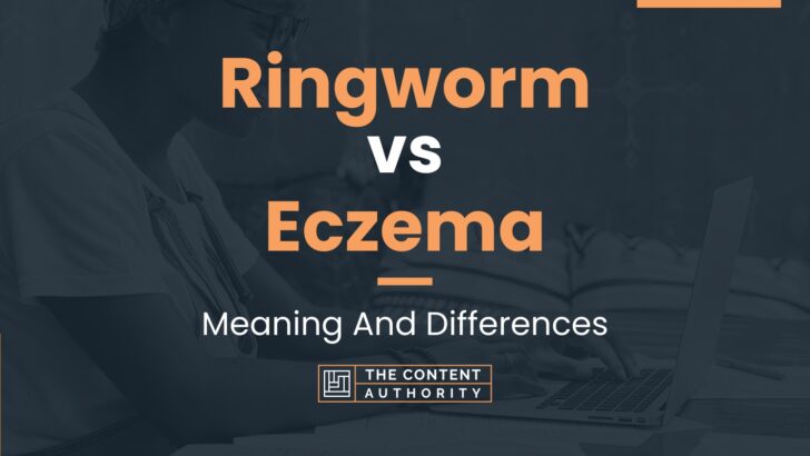 Ringworm vs Eczema: Meaning And Differences