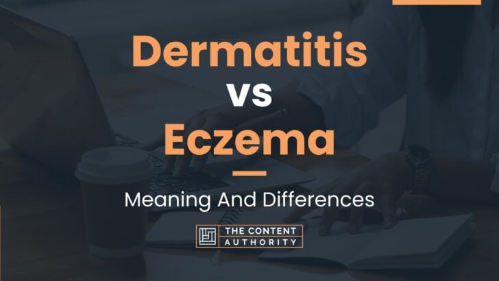 Dermatitis vs Eczema: Meaning And Differences
