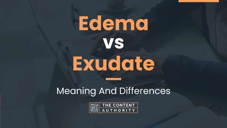 Edema Vs Exudate Meaning And Differences