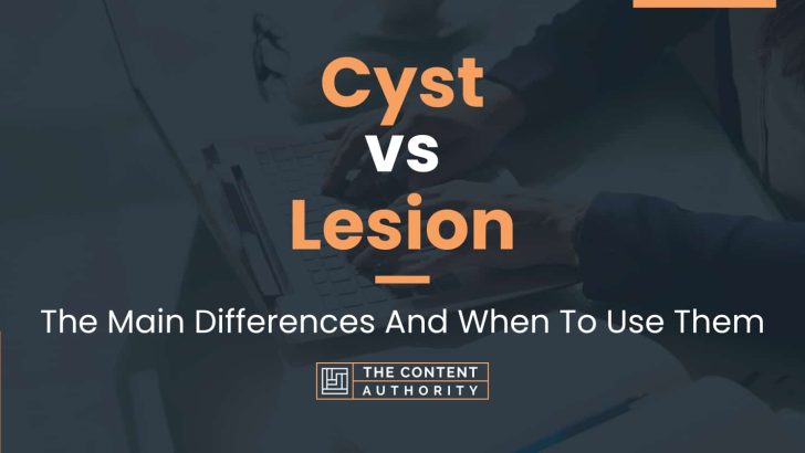 Cyst vs Lesion: The Main Differences And When To Use Them